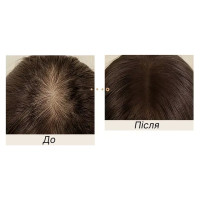 Тонирующая пудра для густоты и линии роста волос ICVC с эффектом объема Dark brown