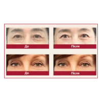 Антивозрастной крем для кожи вокруг глаз K-SECRET Seoul 1988 Retinal Liposome 4% + Fermented Bean 30 мл
